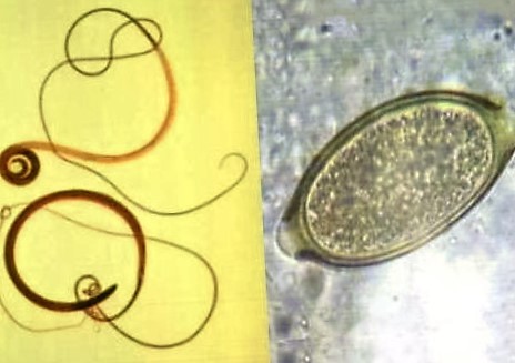 Волосоголовець людський