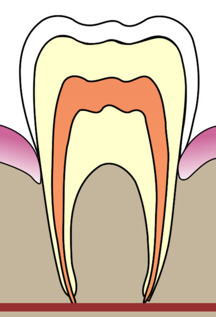 Чи можна виростити новий зуб у людини?