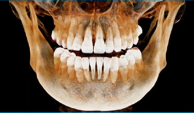 Чи можна виростити новий зуб у людини?